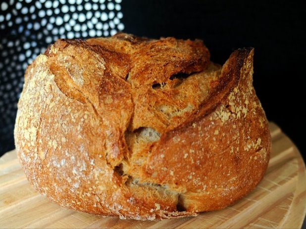 정맥순환장애란??