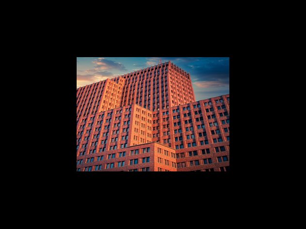 영양실조 단백질 섭취량이 부족