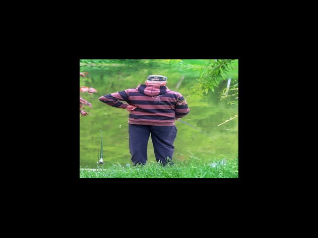 기여금 지급 구조